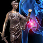 DePuy Pinnacle Hip Lawsuit MDL