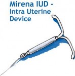 Mirena IUD Lawsuit