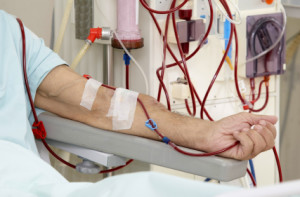 Granuflo Dialysis