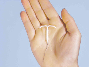 Mirena IUD