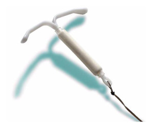 Mirena IUD 